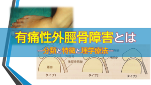 有痛性外脛骨障害とはー分類と特徴と理学療法ー